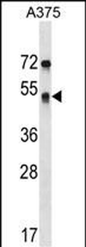 SEPT11 Antibody (Center)