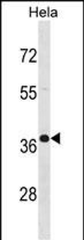 PABPN1 Antibody (C-term)