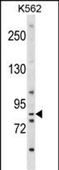 EXT1 Antibody (Center)