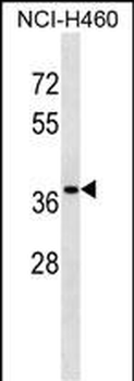CUTC Antibody (Center)