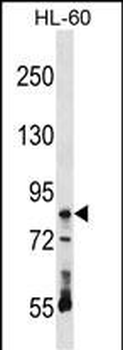 RAVER1 Antibody (N-term)