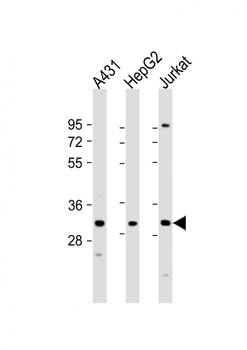 LY6G6F Antibody (N-term)