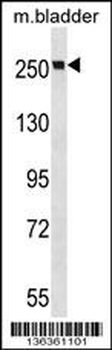 MYH9 Antibody (N-term Y158)