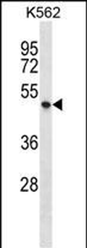 P2RX1 Antibody (C-term)