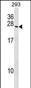 BOK Antibody (N-term)
