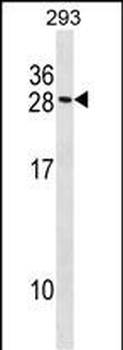 MARCKSL1 Antibody (C-term)