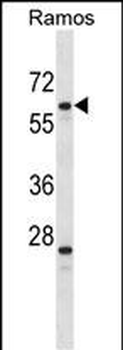 PLRG1 Antibody (N-term)