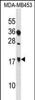SIT1 Antibody (C-term)