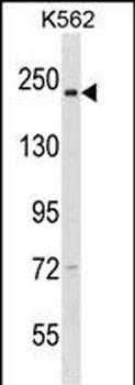 NCAPD3 Antibody (C-term)