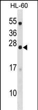 DYNAP Antibody (N-term)