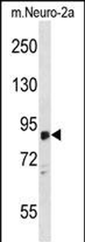 ZDHHC8 Antibody (C-term)