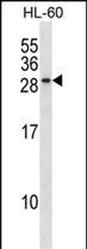 RAB15 Antibody (Center)