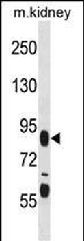 FIGN Antibody (C-term)