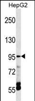 TRPV5 Antibody (C-term)