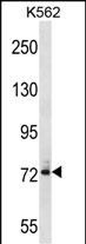 DNAI1 Antibody (N-term)