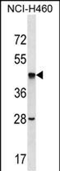 SEPT2 Antibody (C-term)