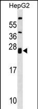 ZNRF1 Antibody (Center)