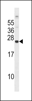 GPX8 Antibody (C-term)