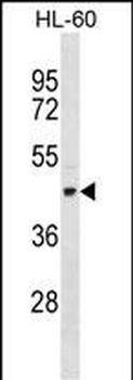 TEKT1 Antibody (Center)