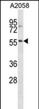 NACC2 Antibody (C-term)