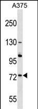ACOX2 Antibody (N-term)