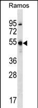 FOXJ2 Antibody (N-term)