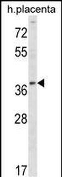 UBE2Q2 Antibody (Center)