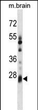 KCTD6 Antibody (Center)