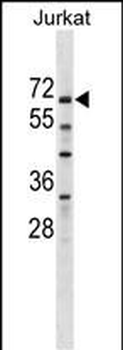 ZNF498 Antibody (Center)