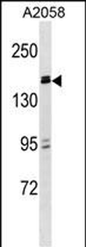 ZBTB38 Antibody (N-term)