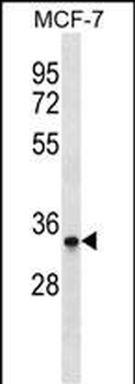 MAD2L1BP Antibody (N-term)
