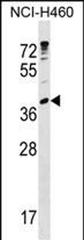 UBE2U Antibody (N-term)