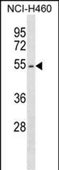 EPOR Antibody (Center)
