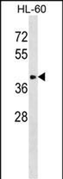 ST8SIA6 Antibody (Center)