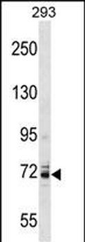 KCNC4 Antibody (C-term)