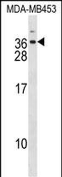 DLX6 Antibody (Center)