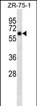 ARSD Antibody (C-term)