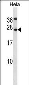LEP Antibody (N-term)
