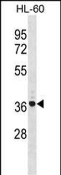 TNIP2 Antibody (Center)