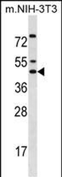 IRX5 Antibody (C-term)