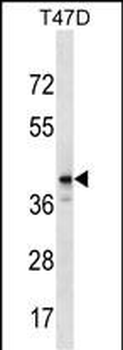 ZNF124 Antibody (N-term)