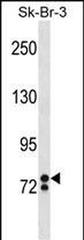 ZNF263 Antibody (Center)