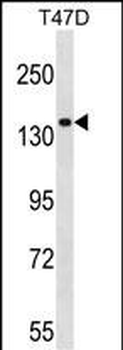 MYO1E Antibody (N-term)