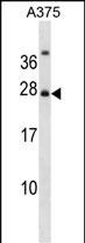 RPAIN Antibody (N-term)
