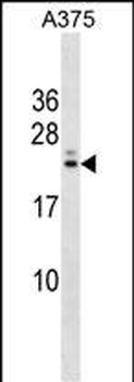 RYBP Antibody (N-term)