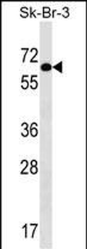 TRIP4 Antibody (Center)