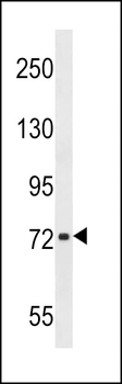 CHADL Antibody (Center)