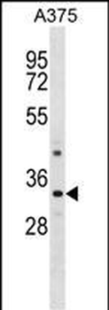 PRR7 Antibody (C-term)