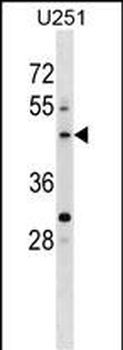 PLEKHO2 Antibody (N-term)