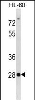 SDCBP2 Antibody (N-term)